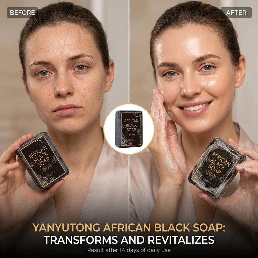 African Black Soap, Contains Shea Butter Oil, Moisturizing Cleansing Soap, Deep Cleansing, Hydrates the Skin, Enhances Skin Tone