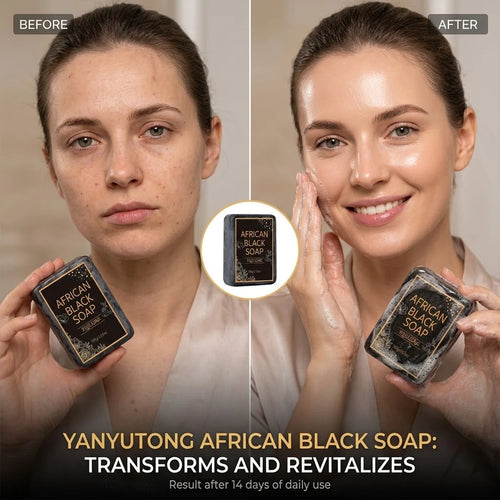 African Black Soap, Contains Shea Butter Oil, Moisturizing Cleansing Soap, Deep Cleansing, Hydrates the Skin, Enhances Skin Tone